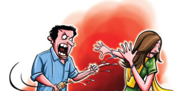 जलनको उपचार निःशुल्क हुने