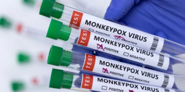 मंकिपक्स