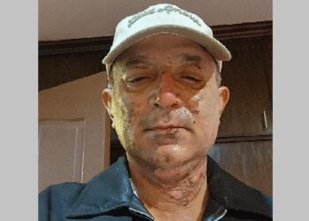 पोखराका नगरप्रमुख आचार्य आइसोलेसनमा