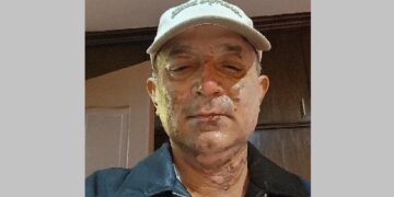 पोखराका नगरप्रमुख आचार्य आइसोलेसनमा