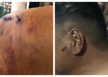 पूर्वसांसदका छोरामाथि गाउँपालिका अध्यक्षद्वारा  कुटपिट