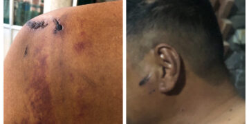 पूर्वसांसदका छोरामाथि गाउँपालिका अध्यक्षद्वारा  कुटपिट